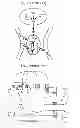Fig. 02 - Methods and devices for activating brown adipose tissue with light