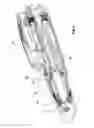 Fig. 03 - Medicament delivery device with dose re-setting