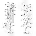 Fig. 02 - Tampon with extended groove forms