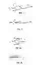 Fig. 05 - INTRA-LUMINAL ACCESS APPARATUS AND METHODS OF USING THE SAME