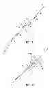 Fig. 07 - INTRA-LUMINAL ACCESS APPARATUS AND METHODS OF USING THE SAME