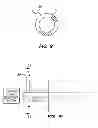 Fig. 06 - DRAINAGE CANNULA WITH ANCHOR TAB