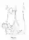 Fig. 02 - RENAL NERVE MODULATION DEVICES