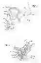 Fig. 02 - Median lobe destruction apparatus and method
