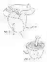 Fig. 03 - Median lobe destruction apparatus and method