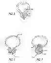 Fig. 04 - Median lobe destruction apparatus and method