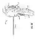 Fig. 06 - Median lobe destruction apparatus and method