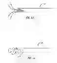 Fig. 12 - Median lobe destruction apparatus and method