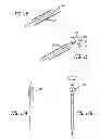 Fig. 13 - Median lobe destruction apparatus and method