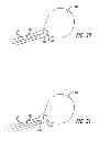 Fig. 15 - Median lobe destruction apparatus and method