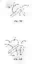 Fig. 17 - Median lobe destruction apparatus and method