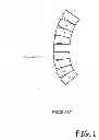 Fig. 02 - MOBILE KYPHOSIS ANGLE MEASUREMENT