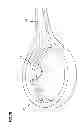 Fig. 13 - Wound closure product