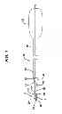 Fig. 02 - Anchor inserter