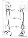 Fig. 01 - INTERNAL DYNAMIC SPLINT AND METHOD FOR USE THEREOF