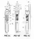 Fig. 02 - INTERNAL DYNAMIC SPLINT AND METHOD FOR USE THEREOF