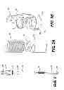 Fig. 03 - INTERNAL DYNAMIC SPLINT AND METHOD FOR USE THEREOF