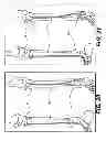 Fig. 20 - INTERNAL DYNAMIC SPLINT AND METHOD FOR USE THEREOF