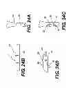 Fig. 22 - INTERNAL DYNAMIC SPLINT AND METHOD FOR USE THEREOF