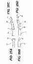 Fig. 23 - INTERNAL DYNAMIC SPLINT AND METHOD FOR USE THEREOF