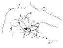 Fig. 01 - Therapy delivery method and system for implantable medical devices