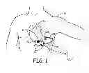 Fig. 02 - Therapy delivery method and system for implantable medical devices