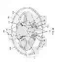 Fig. 07 - Method for epidural stimulation of neural structures