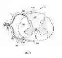 Fig. 08 - Method for epidural stimulation of neural structures