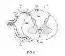 Fig. 09 - Method for epidural stimulation of neural structures
