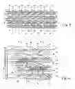 Fig. 06 - Stent delivery system