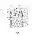 Fig. 08 - Cardiac valve prosthesis deployment system