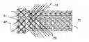 Fig. 01 - Atraumatic stent and method and apparatus for making the same