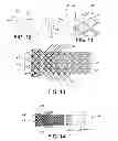 Fig. 06 - Atraumatic stent and method and apparatus for making the same