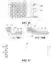 Fig. 07 - Atraumatic stent and method and apparatus for making the same