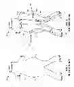 Fig. 02 - Embolization device and a method of using the same