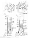 Fig. 02 - Two-part prosthetic valve system