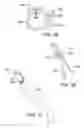 Fig. 17 - Two-part prosthetic valve system