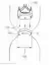 Fig. 01 - Heart valve assemblies