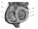 Fig. 01 - Patient-specific intraluminal implants