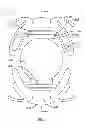 Fig. 02 - Intraocular lens