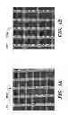 Fig. 02 - METHOD FOR USING A SILK DERIVED BIORESORBABLE SCAFFOLD IN BREAST RECONSTRUCTION