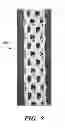 Fig. 09 - METHOD FOR USING A SILK DERIVED BIORESORBABLE SCAFFOLD IN BREAST RECONSTRUCTION