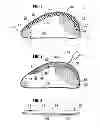 Fig. 02 - TISSUE EXPANDER WITH SELF-HEALING ANTERIOR SIDE