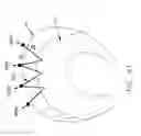 Fig. 40 - Method and apparatus for re-attaching the labrum of a hip joint
