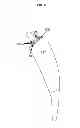 Fig. 07 - Artificial joint components including synovial fluid deflecting structures and particle retaining structures
