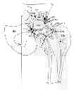 Fig. 01 - Artificial joint components including mechanized synovial fluid deflecting structures and particle retaining structures
