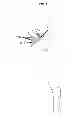 Fig. 07 - Artificial joint components including mechanized synovial fluid deflecting structures and particle retaining structures