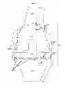 Fig. 09 - Artificial joint components including mechanized synovial fluid deflecting structures and particle retaining structures