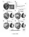 Fig. 06 - System and method for planning a patient-specific cardiac procedure