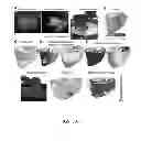 Fig. 08 - System and method for planning a patient-specific cardiac procedure